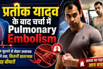 Pulmonary Embolism