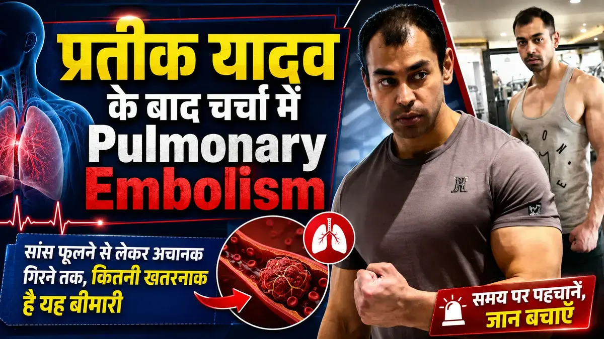 Pulmonary Embolism